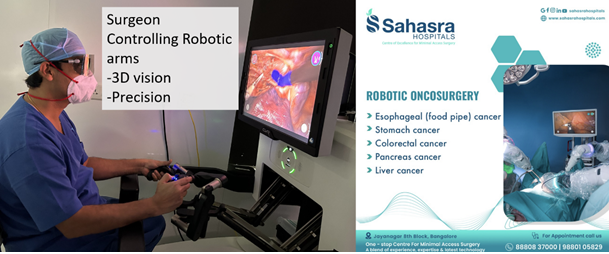 Robotic Esophagectomy in Bangalore